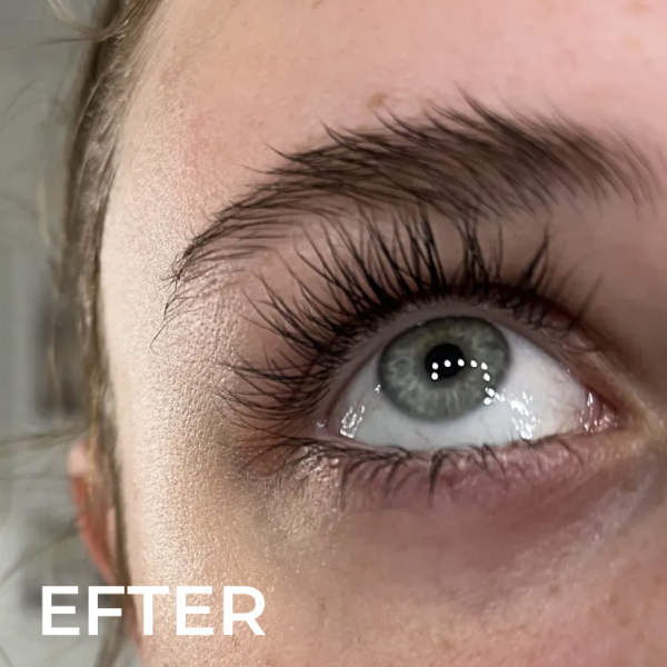 Aphro Celina VippeSerum EFTER