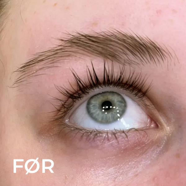 Aphro Celina VippeSerum FØR