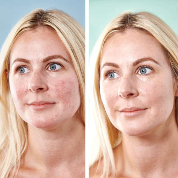 Sorted Skin 5 in 1 Anti-Redness Day Cream SPF50 30 ml 5 in 1 Anti-Redness Day Cream SPF50 – Farvekorrigerende Dagcreme mod Rødme (30 ml)